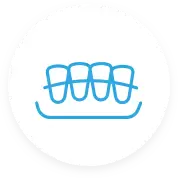 aligners