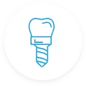dental-implants